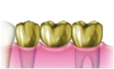 18K 白金加金